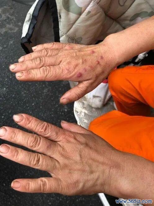 高温下“制服蒸笼”困住环卫工 酷暑中的坚守与困境